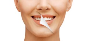 A SMILE FOR EVERY AGE: UNDERSTANDING SMILE RECONSTRUCTION OPTIONS