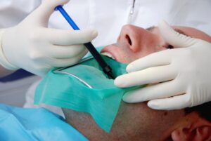 DEBUNKING MYTHS AND CLARIFYING FACTS: THE TRUTH ABOUT ROOT CANAL TREATMENT