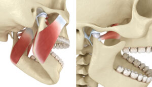 CLICKING TO LOCK JAW – TMDS