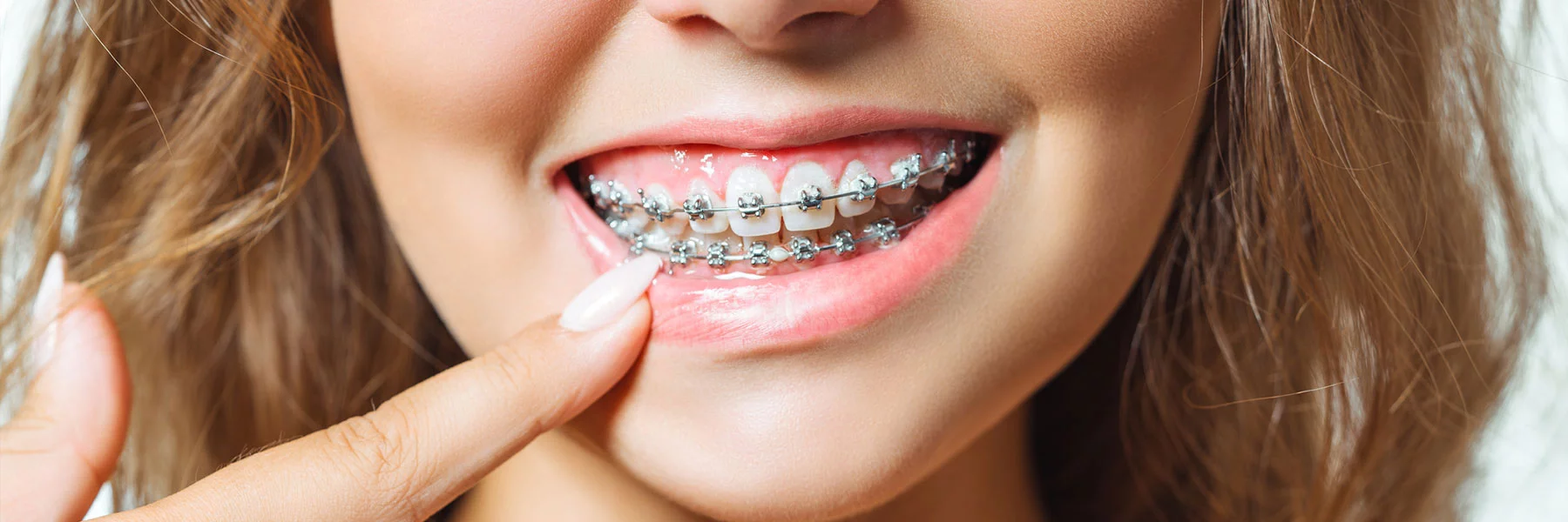 Braces in Kharghar