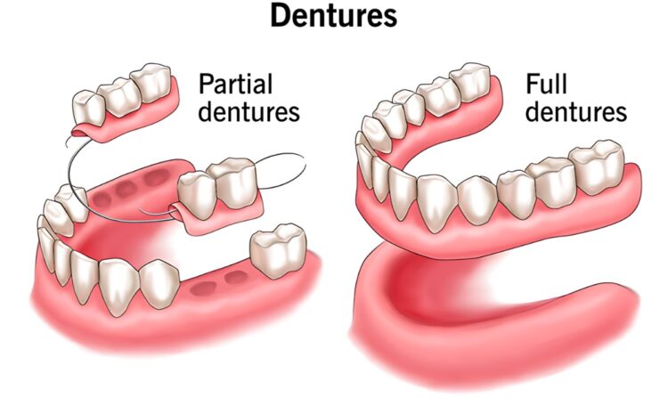 Dentures in Kharghar, Navi Mumbai