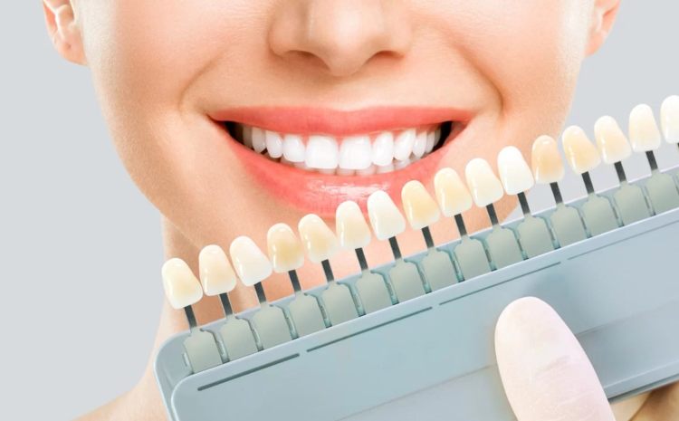  Winter Weddings and Events? Consider Cosmetic Dentistry for a Stunning Smile