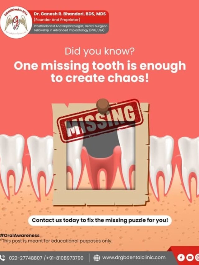 Don’t let gaps hold you back from confidence. Our expert dental team is here to help you restore your smile with seamless, natural-looking solutions.