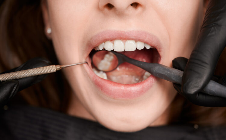  Why Does My Tooth Hurt Without Cavities? 5 Possible Reasons 