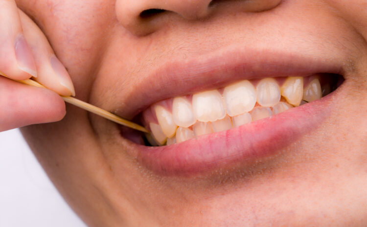  What Causes Yellow Teeth Even After Brushing? 