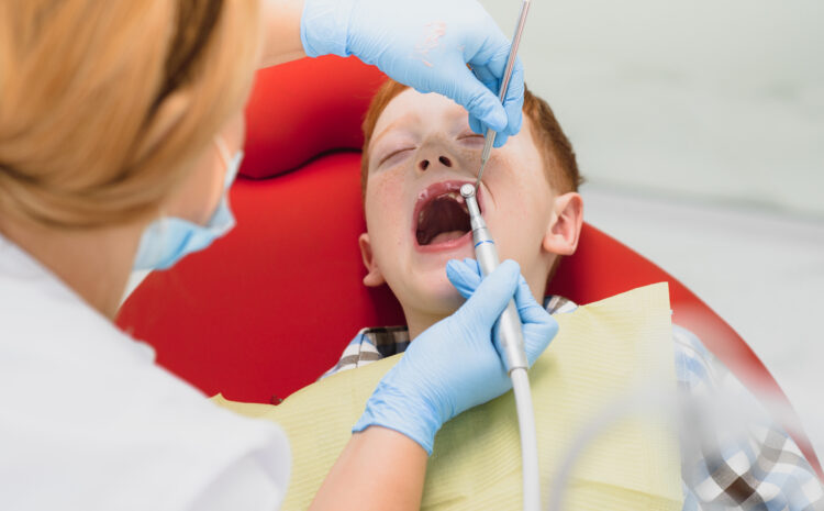  Can Food Getting Stuck Between Teeth Indicate a Cavity? 