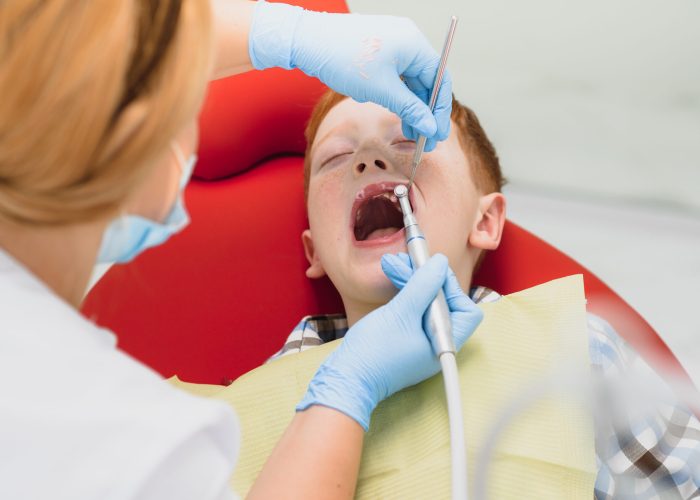 Can Food Getting Stuck Between Teeth Indicate a Cavity?