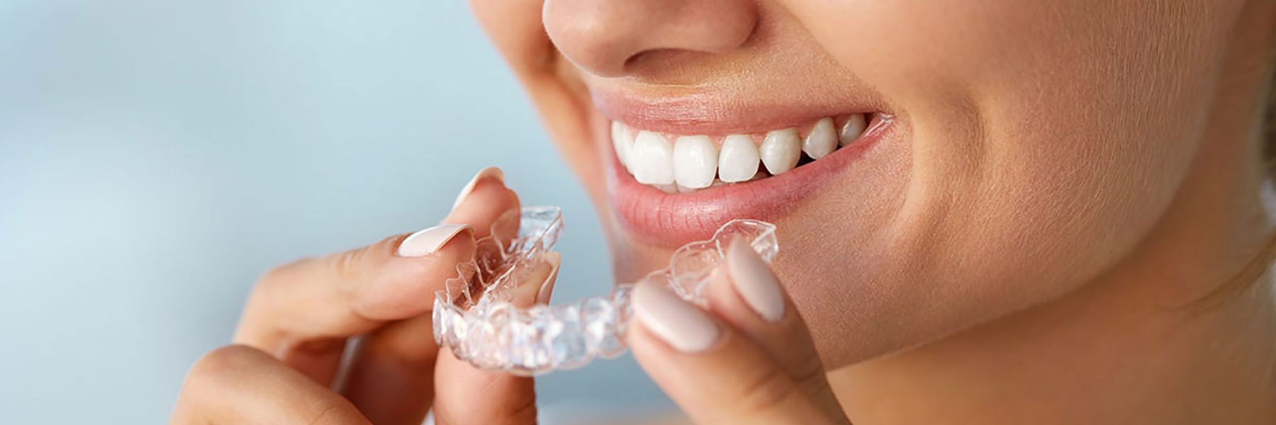 Clear Aligners in Kharghar