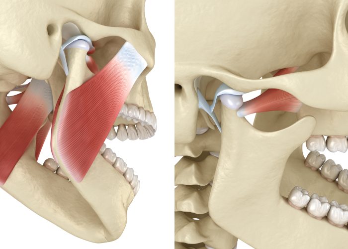 Clicking To Lock Jaw – TMDS