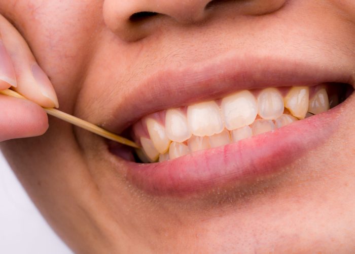 What Causes Yellow Teeth Even After Brushing?